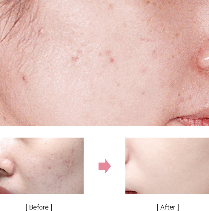 Before, After