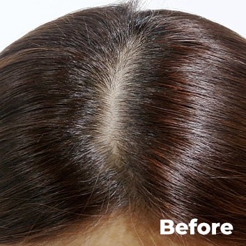 Before, Pang Pang Hair Shadow