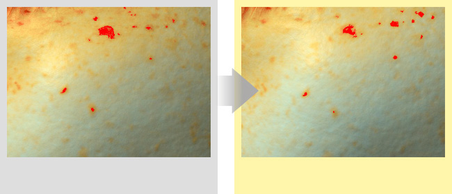 Comparison of number of pigmentation spots before and after 2 weeks of use