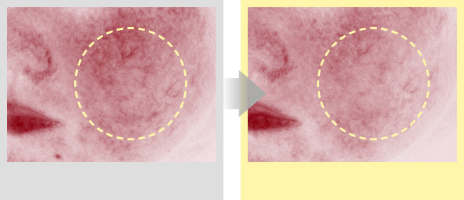 Comparison of number of red spots before and after 2 weeks of use
