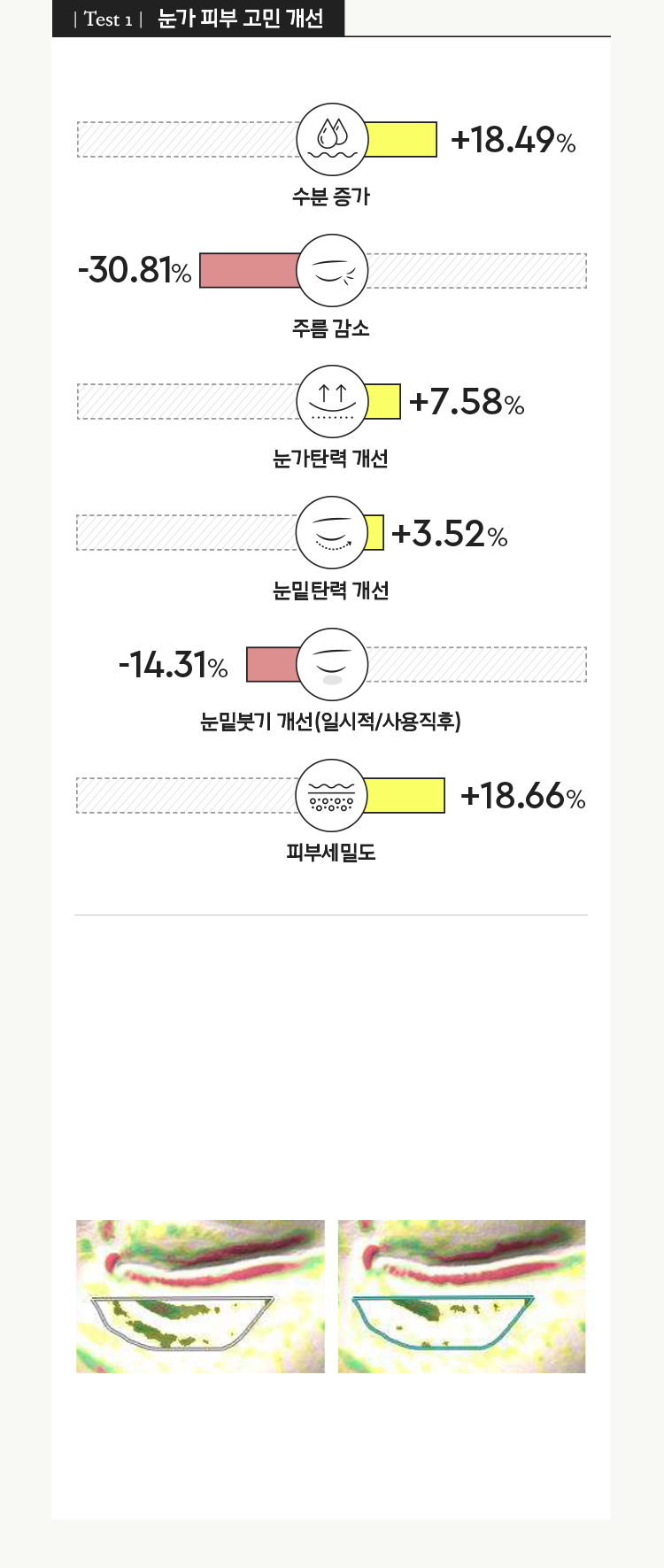 Test 1 눈가 피부 고민 개선 +18.49% 수분 증가, -30.81% 주름 감소, +7.58% 눈가탄력 개선, +3.52% 눈밑탄력 개선, -14.31% 눈밑붓기 개선(일시적/사용직후), +18.66% 피부세밀도