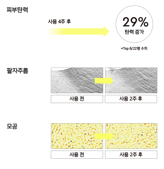 피부탄력 사용 4주후 29% 탄력 증가 *Top6/22명 수치 / 팔자주름 사용 전, 사용 2주후 팔자주름 피부표면 확대 모습 / 모공 사용 전, 사용 2주후 모공 확대 모습