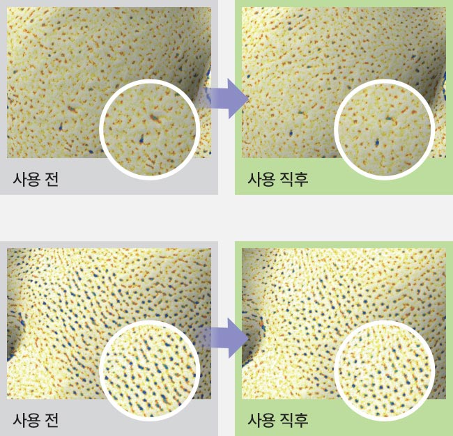 사용 전/사용 직후 모공 수,밀도,깊이,면적,부피 5D 개선 비교