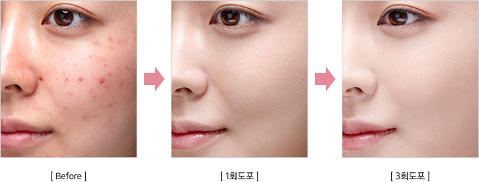 전격 TEST : 커버 핏 파우더 팩트를 사용하기 전 피부, 1회 도포 후 피부, 3회 도포 후 피부