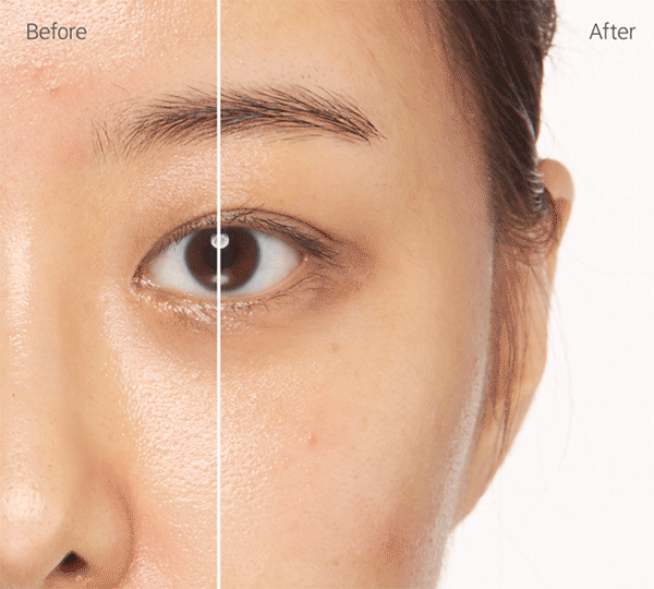 마몽드 하이 커버 크림 코렉터로 다크 서클을 커버하는 before & after 모델 연출 gif
