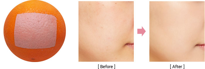 마몽드 하이 커버 크림 코렉터로 모공 부각없이 커버하는 before & after 모델 연출컷
