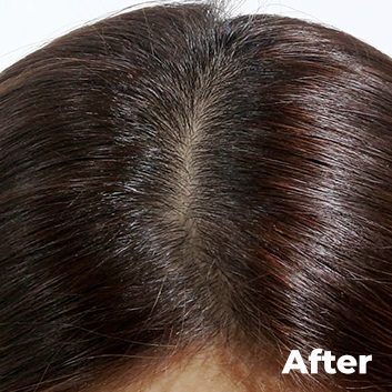 After, 마몽드 팡팡 헤어 섀도우 사용 전 모델의 빼곡하게 채워진 정수리