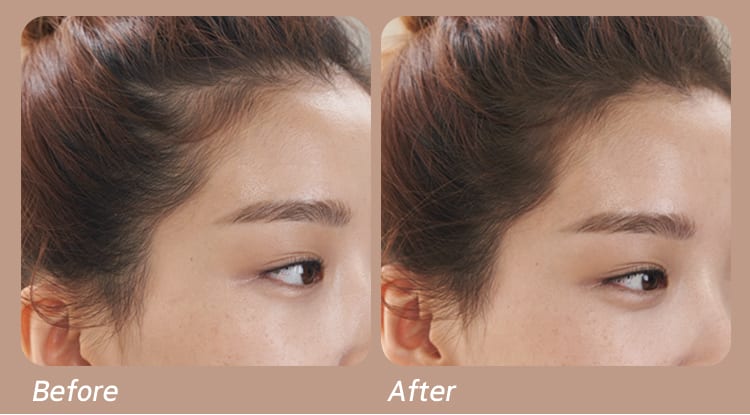 제품 사용 before after사진
