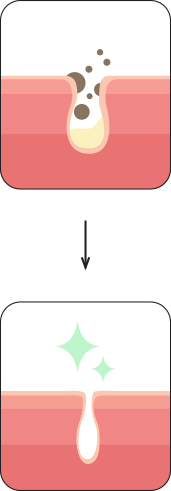 모공 속 노폐물과 피지가 제거되는 모습을 보여주고 있음