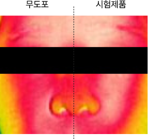 적외선(열) 조사 후 피부 온도가 높은 피부상태