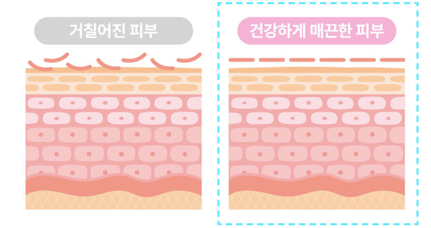 거칠어진피부/건강하게 매끈한 피부