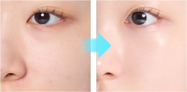 칙칙한 톤,누런 톤 2대 톤고민 해결 before/after