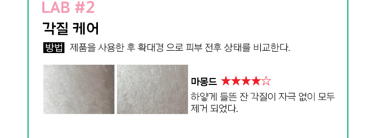 LAB #2 각질 케어