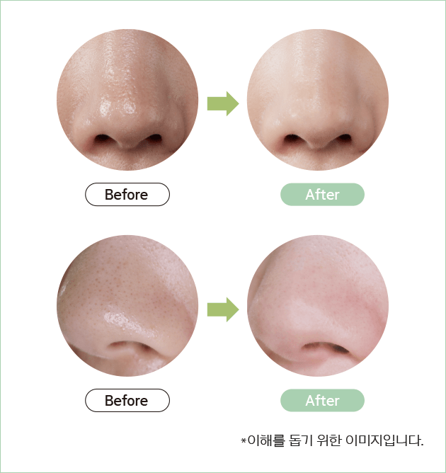 3step before,after/*이해를 돕기 위한 이미지입니다.