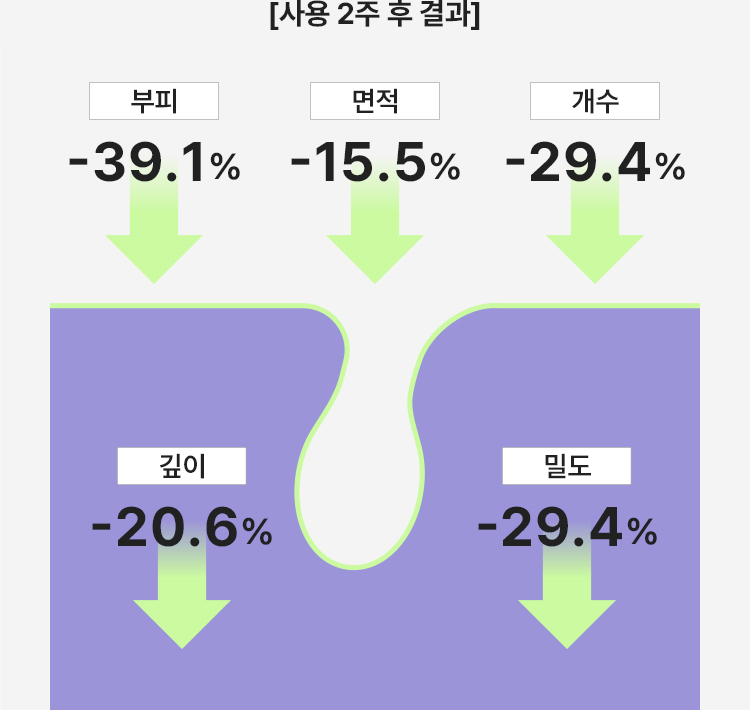 [사용 2주 후 결과] 부피: -39.1%, 면적: -15.5%, 개수 -29.4%, 깊이 -20.6%, 밀도 -29.4%