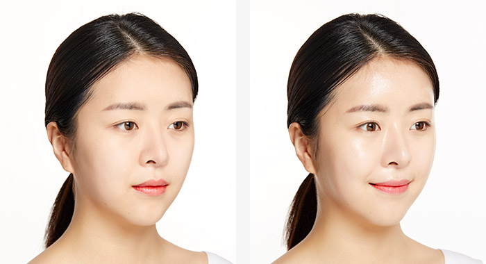 BEFORE AFTER 모습