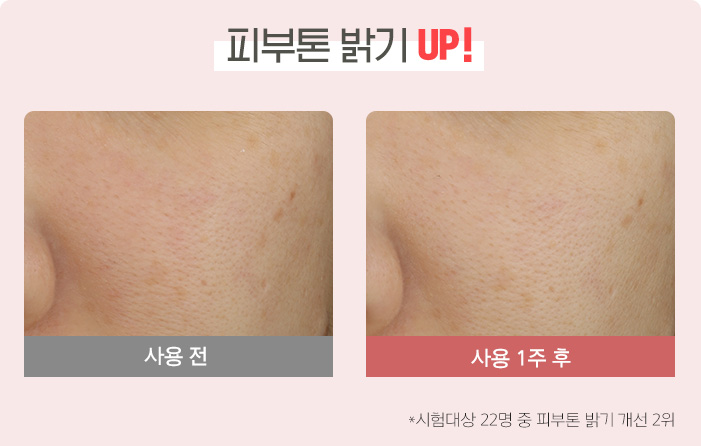 피부톤 밝기 UP! 사용 전, 사용 1주 후, * 시험대상 22명 중 피부톤 밝기 개선 2위