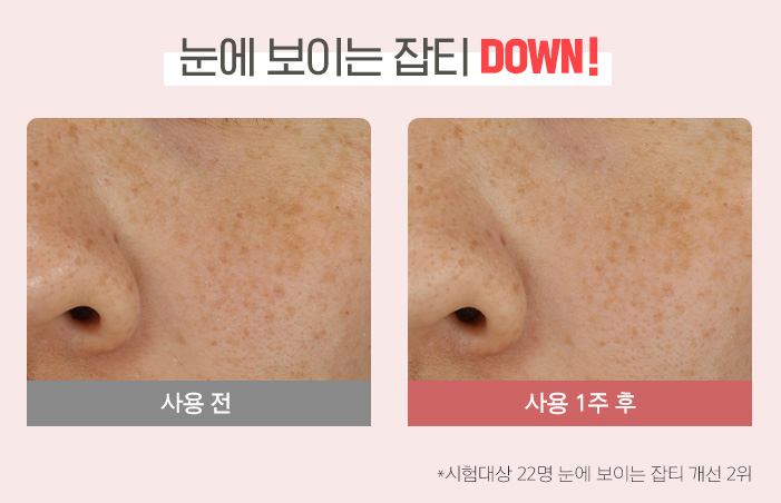 눈에 보이는 잡티 DOWN! 사용 전, 사용 1주 후, * 시험대상 22명 중 잡티 개선 2위