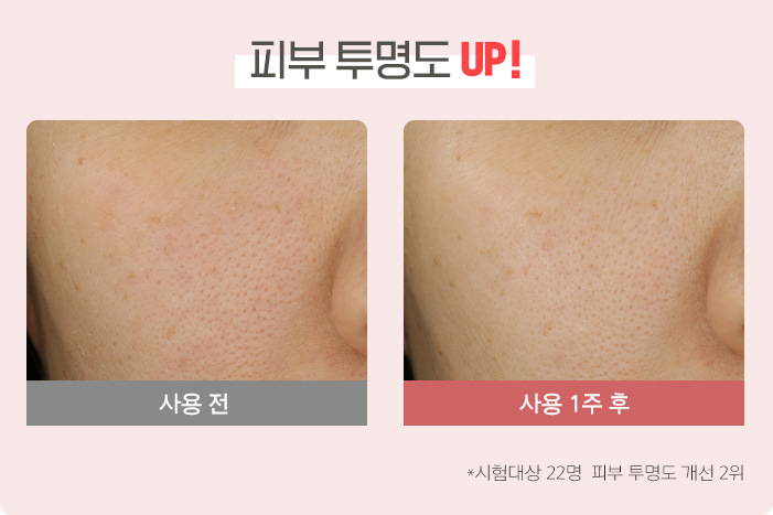 피부 투명도 UP! 사용 전, 사용 1주 후, * 시험대상 22명 중 피부 투명도 개선 2위