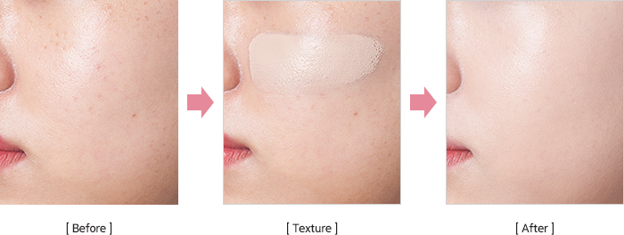 홍조와 트러블이 보이는 before. 토탈 솔루션 비비크림을 얼굴에 부드럽게 도포한 texture 컷. 홍조와 트러블이 커버되고 화사해진 after.