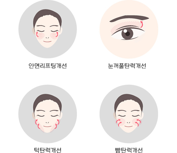 탄력 개선 - 안면리프팅, 눈꺼풀탄력, 턱탄력, 뺨탄력 개선 확인