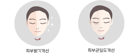 피부톤 개선 - 피부 밝기, 피부 균일도 개선 확인